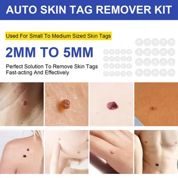 Kožo Oznake Odstranitev Kit | Dual Razredi Oznake Korektor za Kožo Oznake | Kože Tags Orodje za Popravilo s 40 Rubb